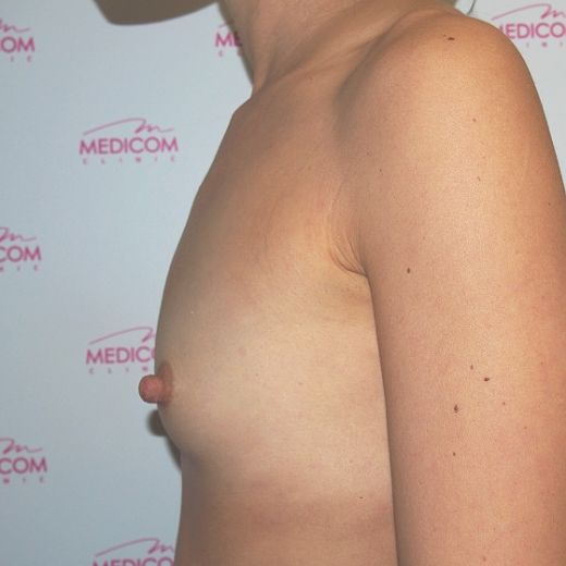 Image before