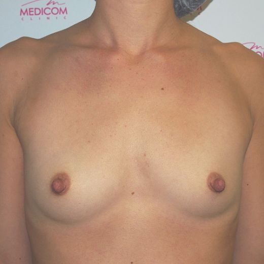 Image before