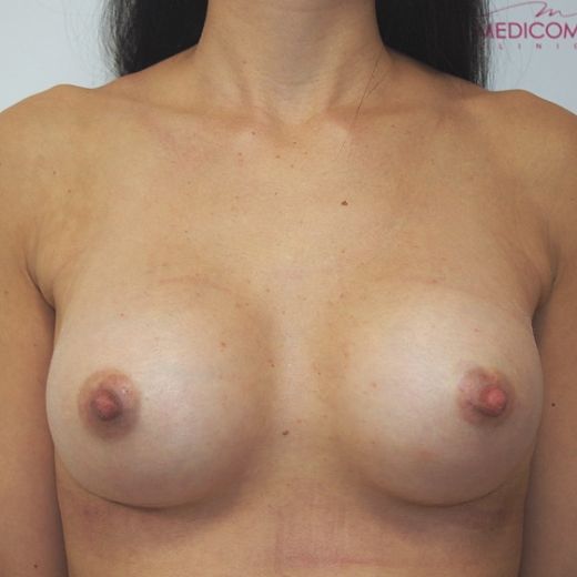 Image after