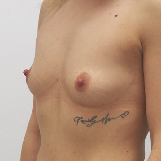 Image before