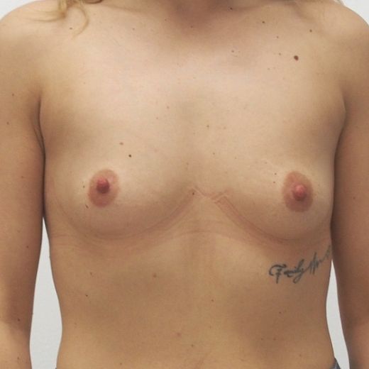 Image before