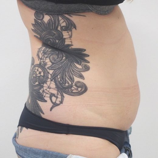 Image before