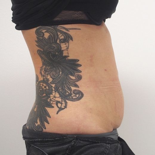 Image after