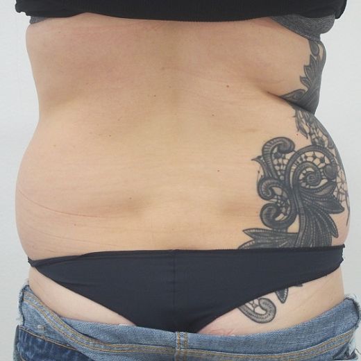 Image before