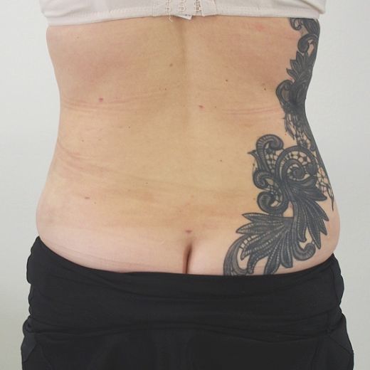 Image after