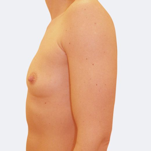 Image before
