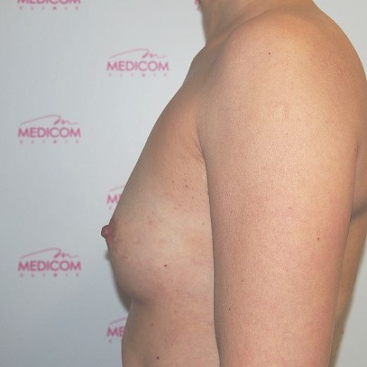 Image before
