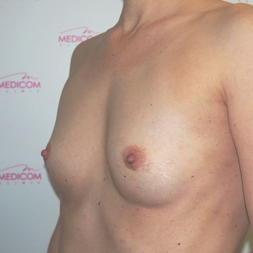 Image before