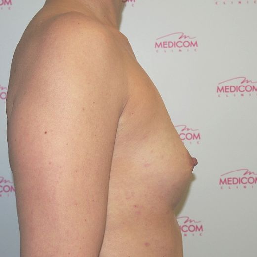 Image before
