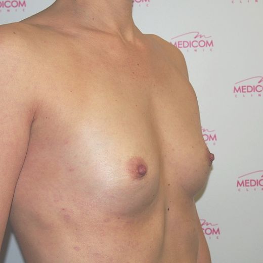 Image before