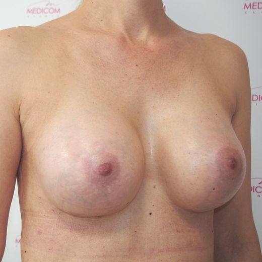 Image after