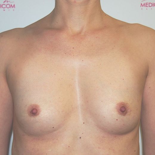 Image before