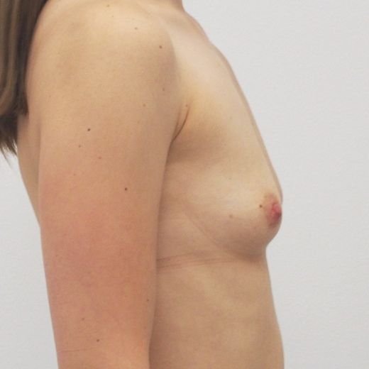Image before