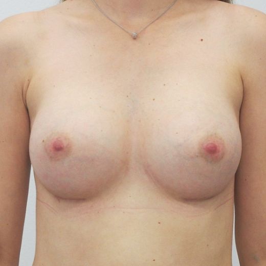 Image after