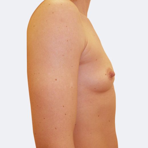 Image before