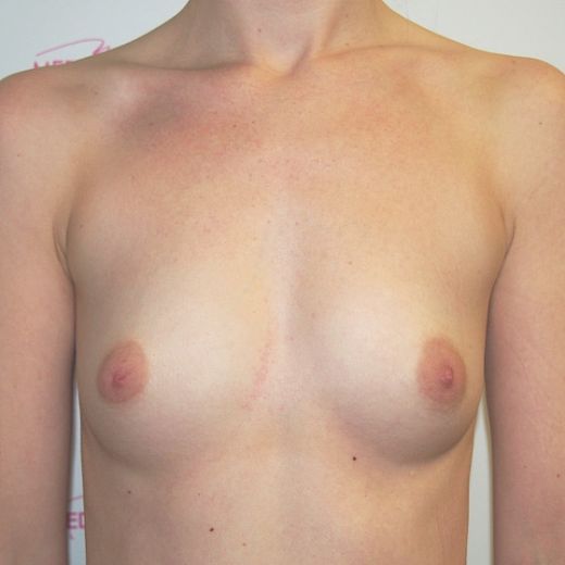 Image before
