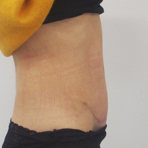 Image after
