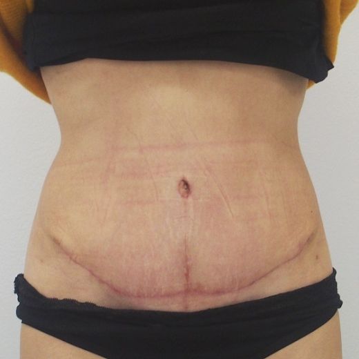 Image after