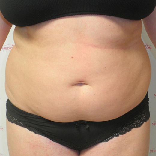 Image before
