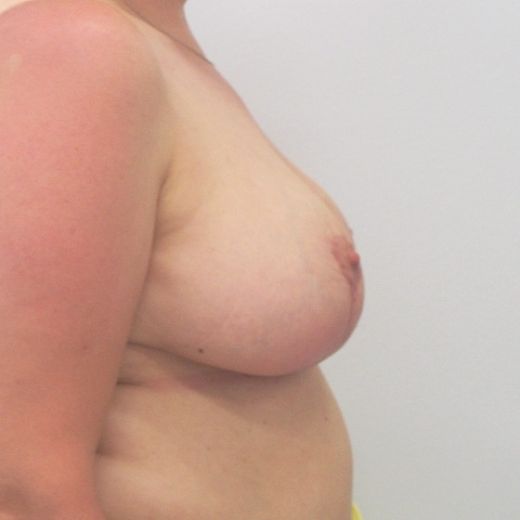 Image after