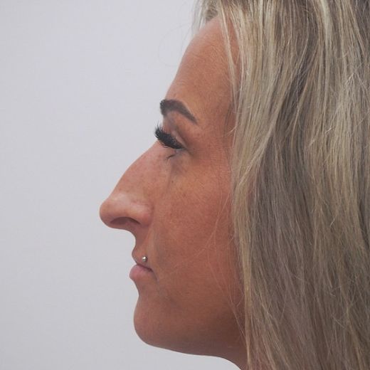 Image before