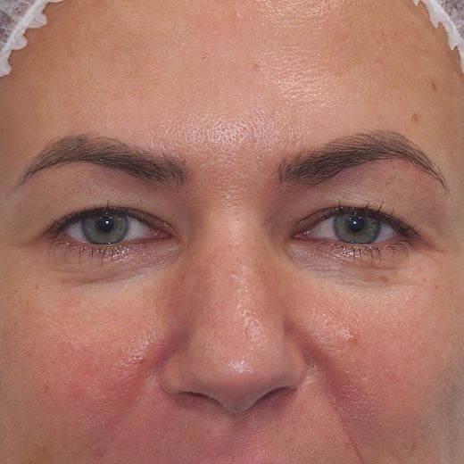 Image before