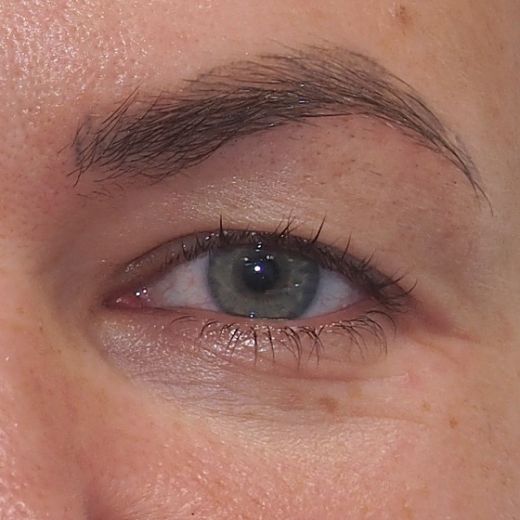 Image before