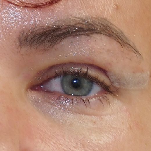 Image after