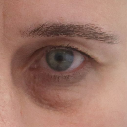 Image before
