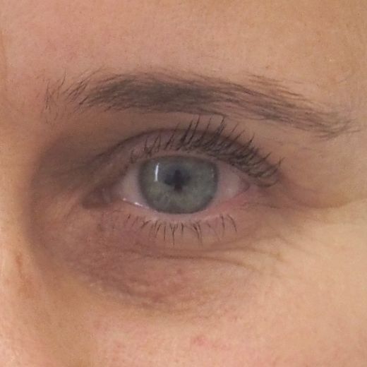 Image after
