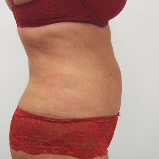 Image after