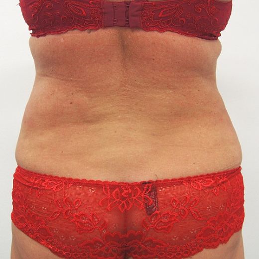 Image after