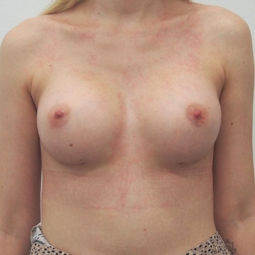 Image after