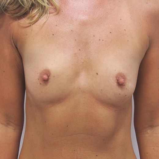 Image before
