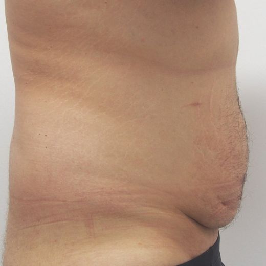 Image before