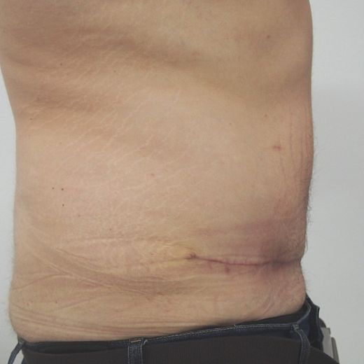 Image after