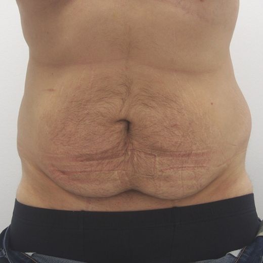 Image before