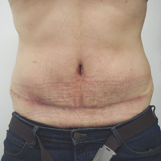 Image after