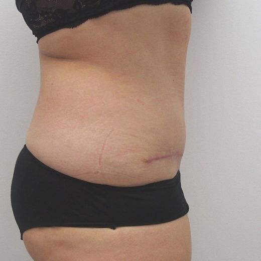 Image after