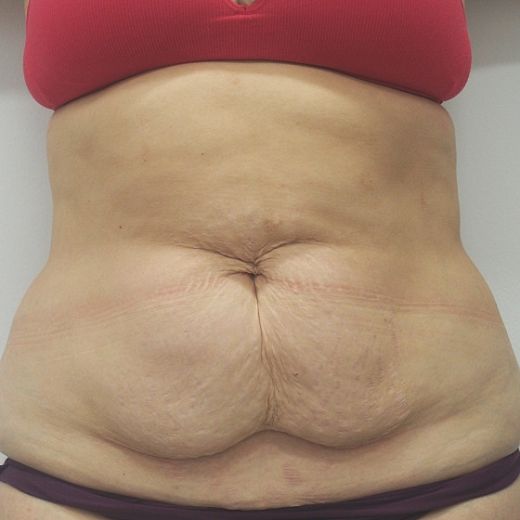 Image before