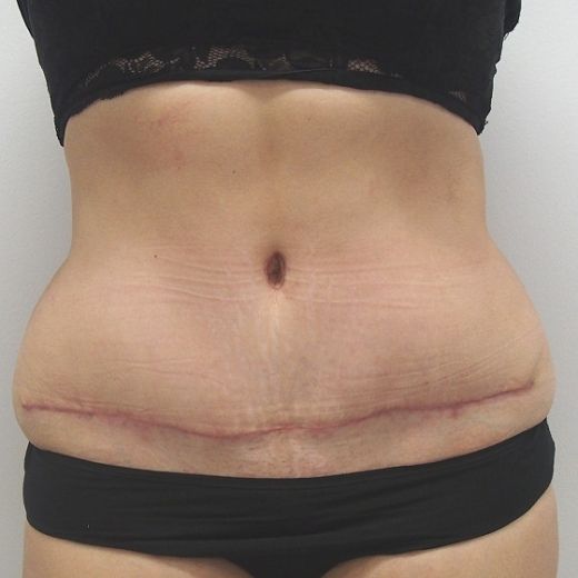 Image after
