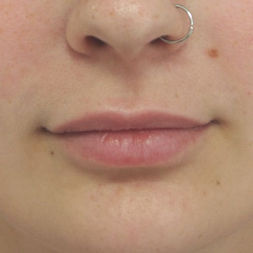 Image before