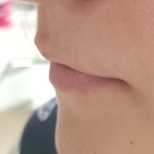 Image before