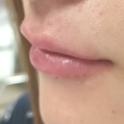 Image after