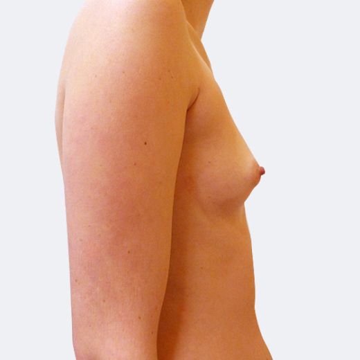 Image before