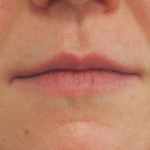 Image before
