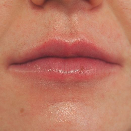 Image after