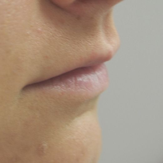 Image before