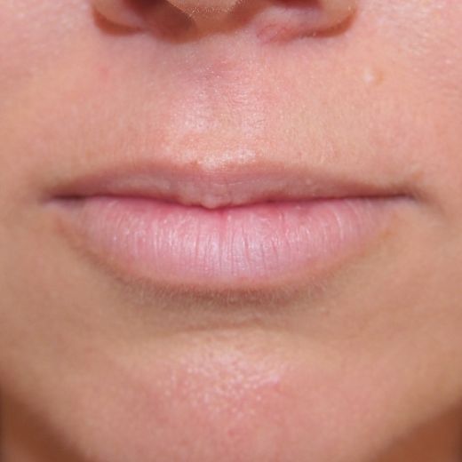 Image before