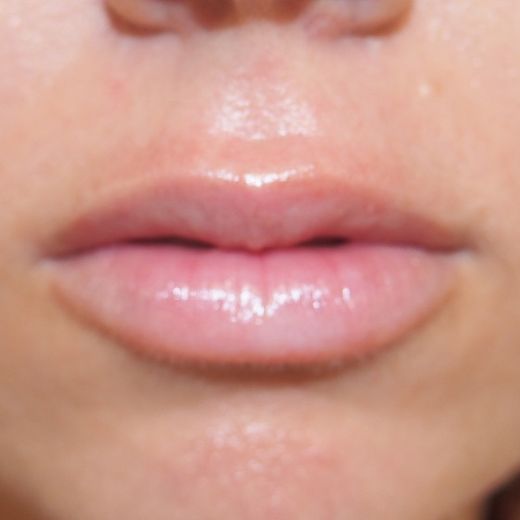 Image after